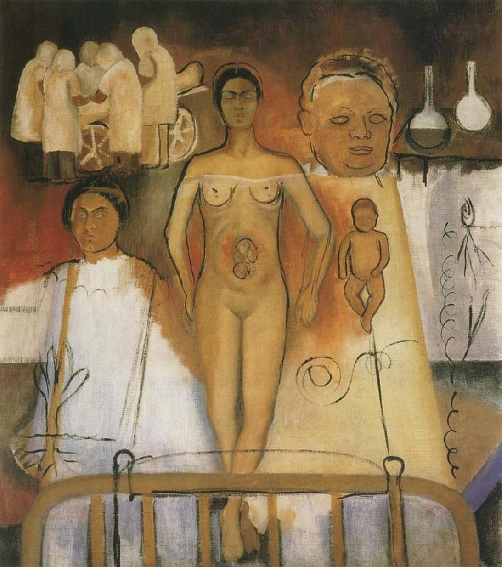 Frida Kahlo Kahlo and Caesarean operation oil painting picture